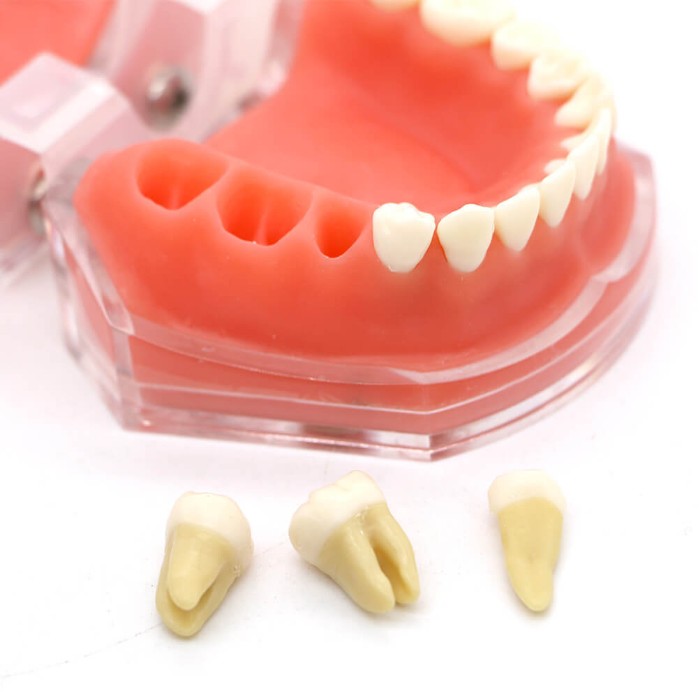 Orthodontic Study Model 4004 with 28 Removable Teeth for Dental Bracket Training