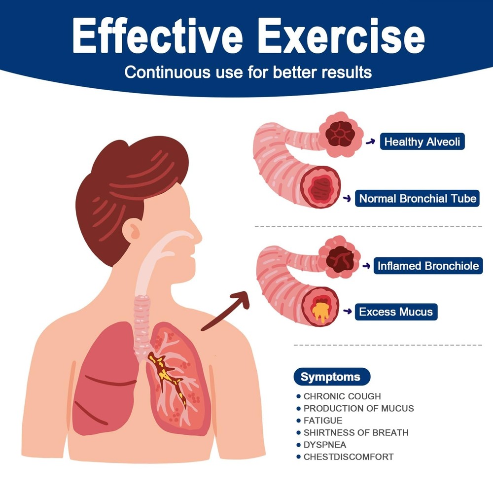 Flutter Valve, Breathing Trainer Blue