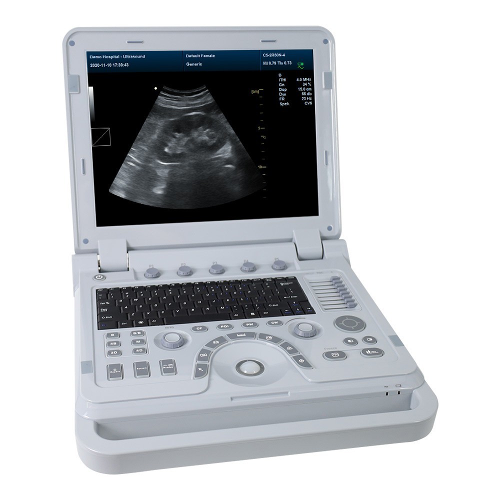 Portable Color Doppler Ultrasound Scanner Machine DiagnosticSystem Convex Linear