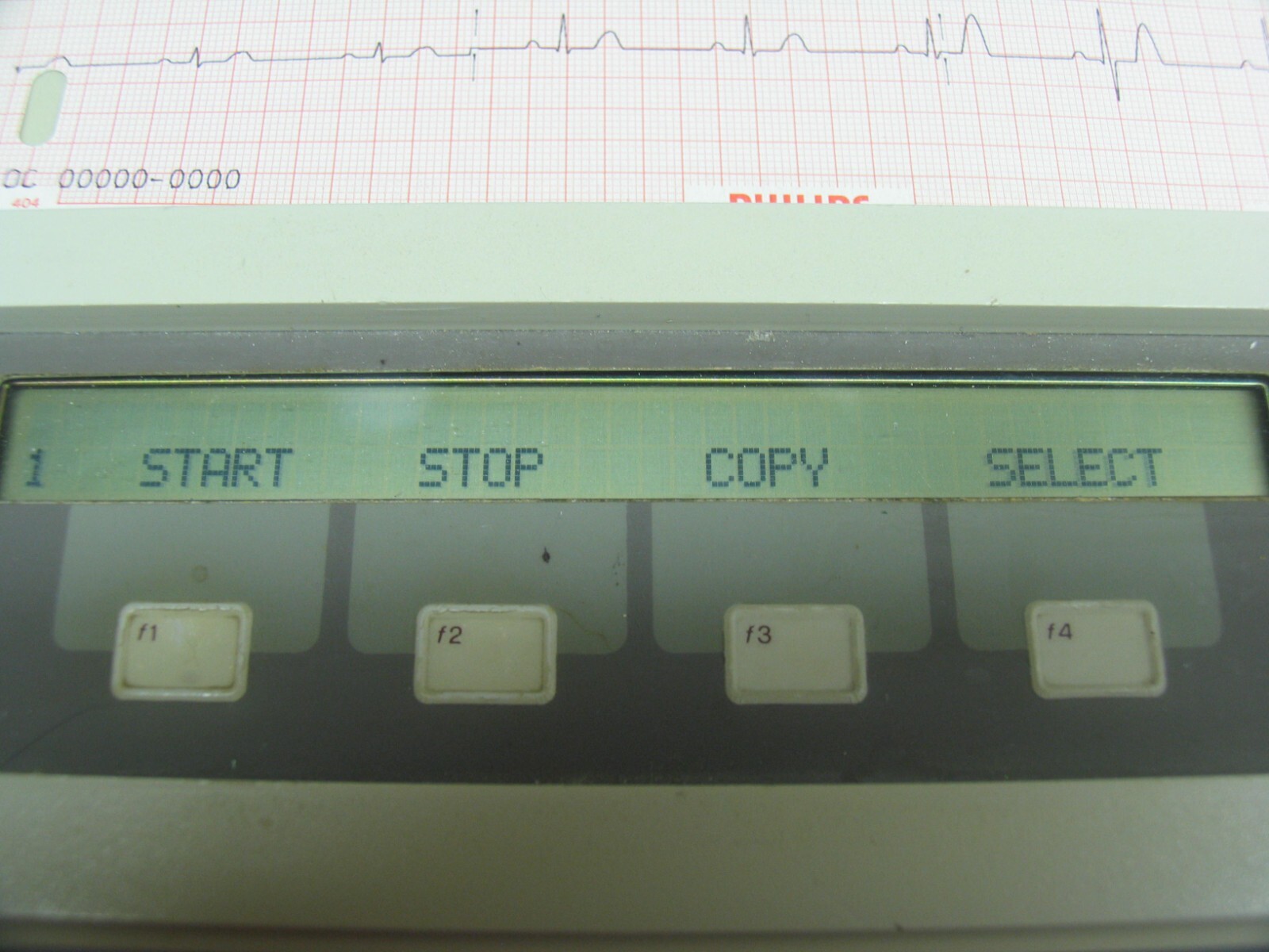 HEWLETT PACKARD (HP) PAGEWRITER II 4755A NON-INTERPATIVE EKG TESTED AND WORKING