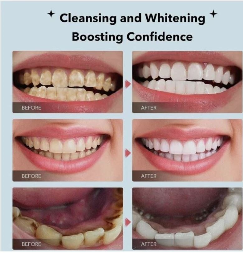 2 - 7.5% Hydroxyapatite Toothpaste Remove Yellow Tooth Stains fr Sensitive Teeth