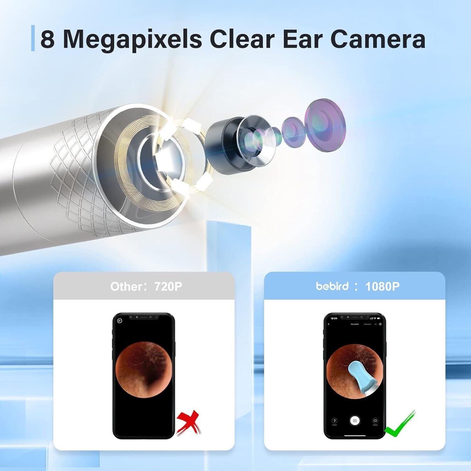 BEBIRD X17 Pro Camera Endoscope Professional Visual Ear Cleaner Ear Wax Removal