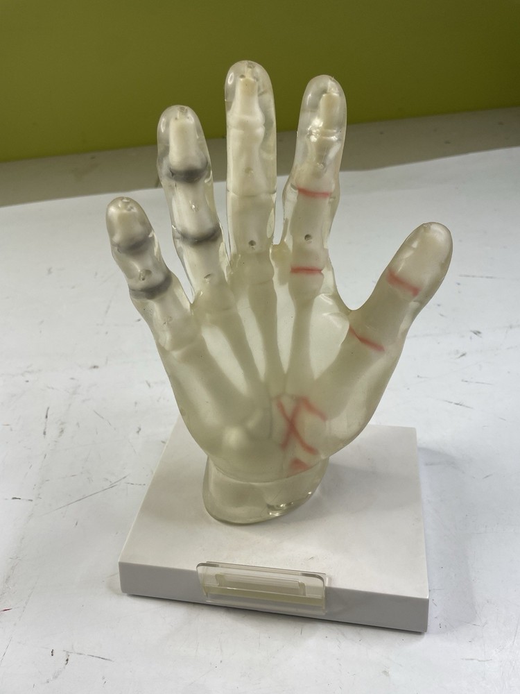 Pharmaceutical Hand Bone vinyl model. Shows joints/bones thru translucent skin