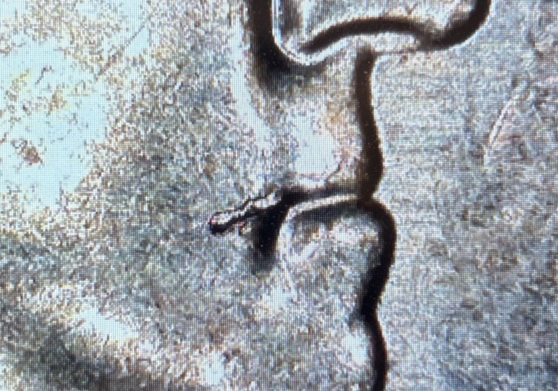 2023 D Edith Kanaka’ole “Drooler” Error