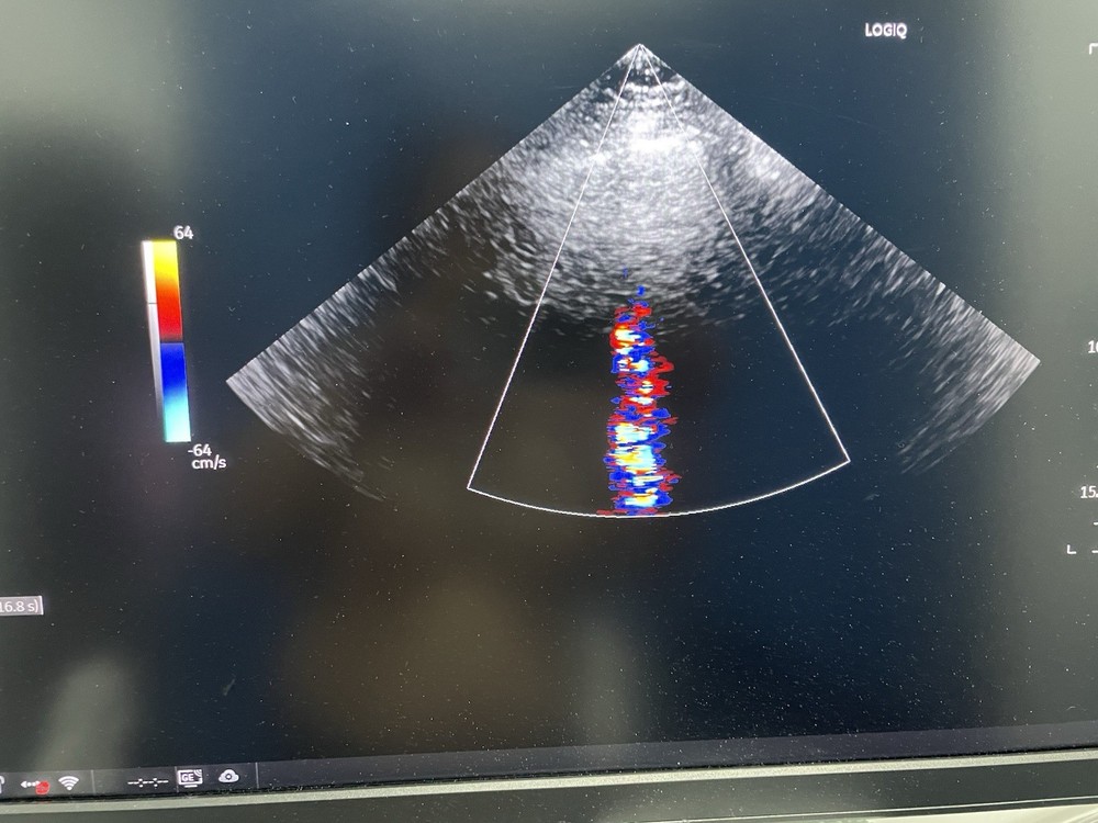 Ge ultrasound probe Phase Array M5SC-D