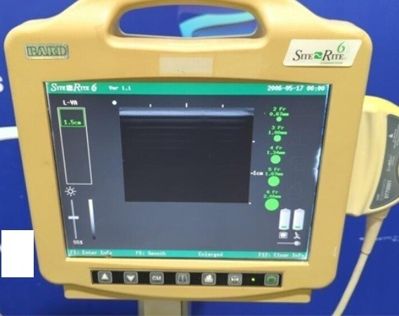 Bard Site Rite 6 Vascular Ultrasound System