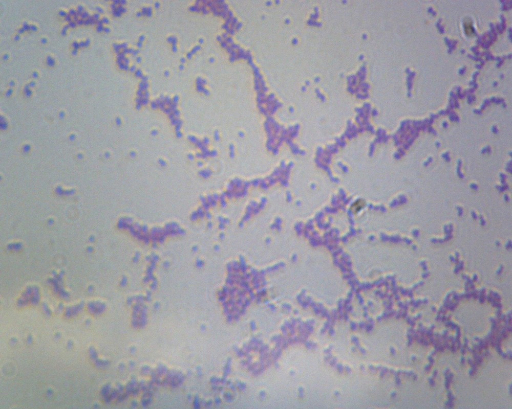 Bacillus; Smear; Gram-Negative