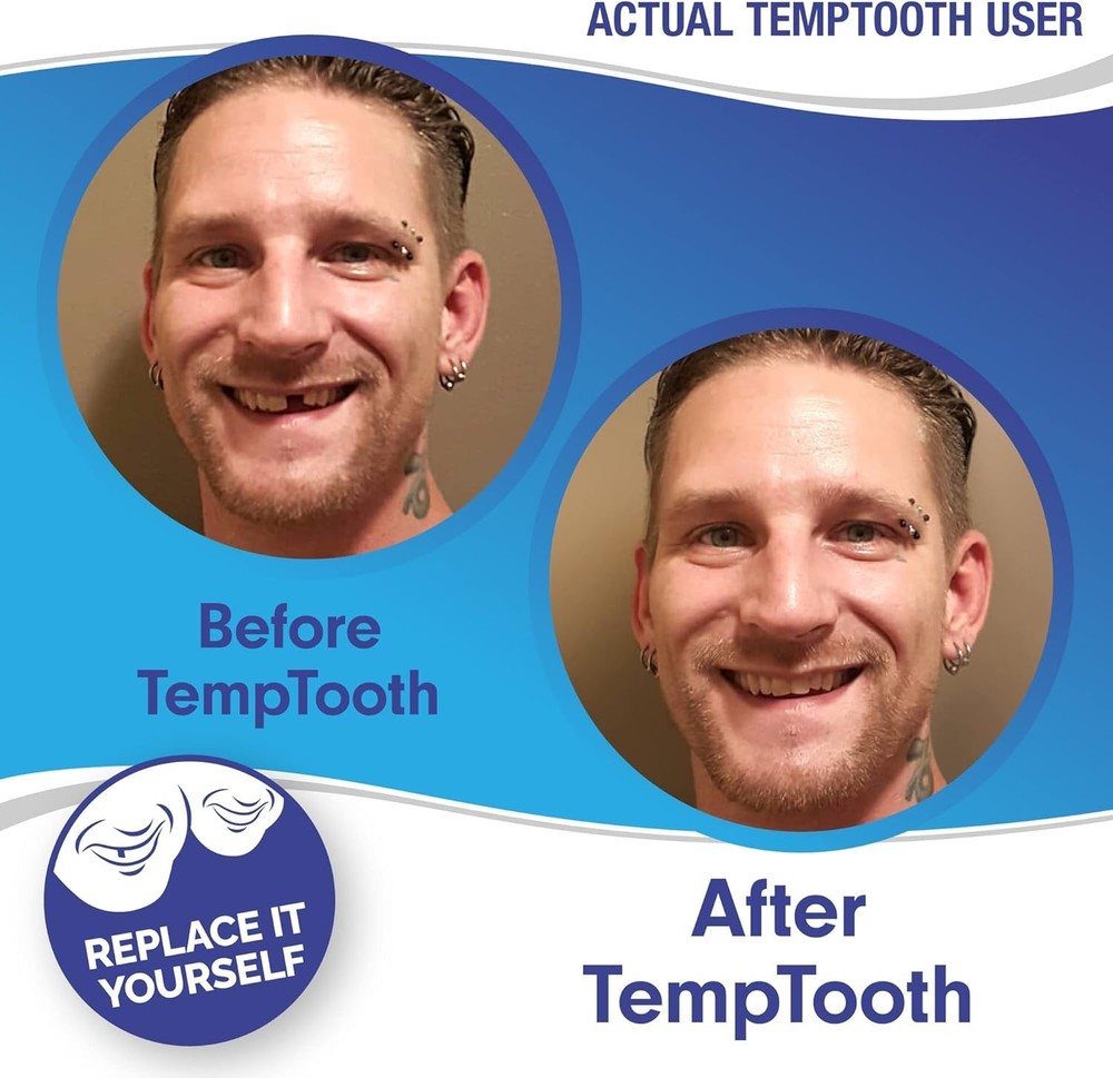 Natural-Looking Temporary Tooth Replacement - DIY Kit with Instructions
