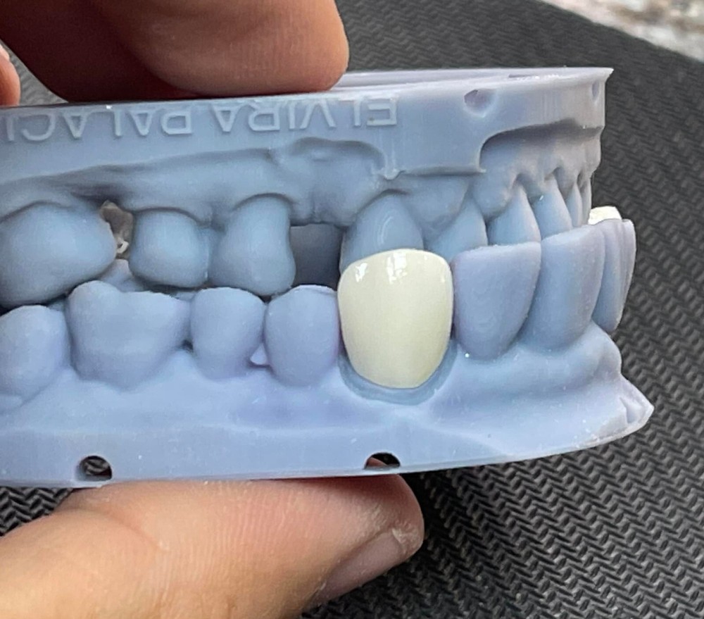 DLP SLA LCD 3d printer temporary teeth resin ..