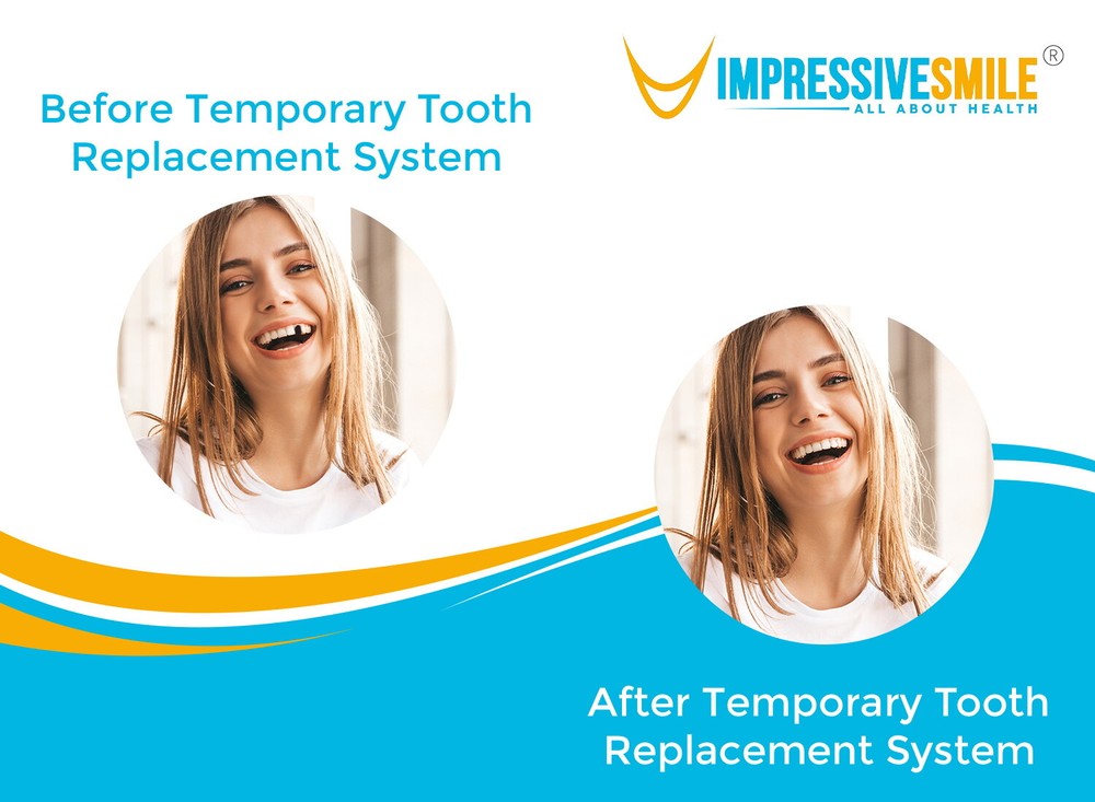 Patient Trusted Temporary Tooth Replacement System