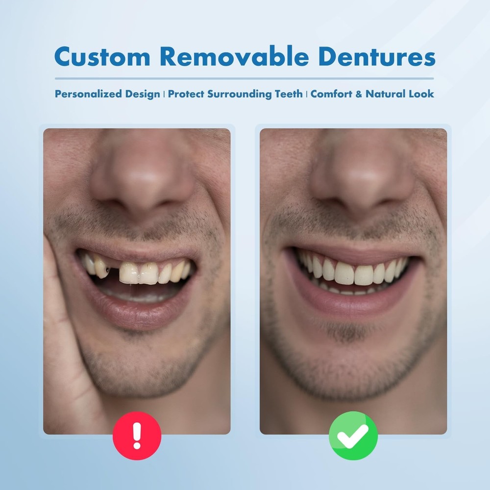 Custom Removable Dentures – Personalized Partial Denture Set for Tooth Rep