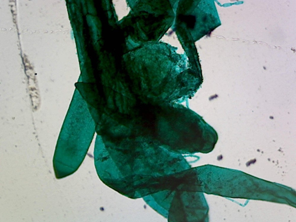 Microscope Slide, Whole-Mount, Chlorophyta Green Algae; Chara; Showing