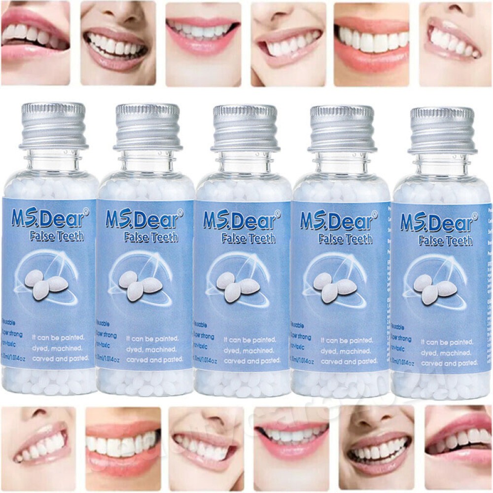 5/3X Tooth Repair Granules Temporary Fitting Beads Reusable Moldable False Teeth