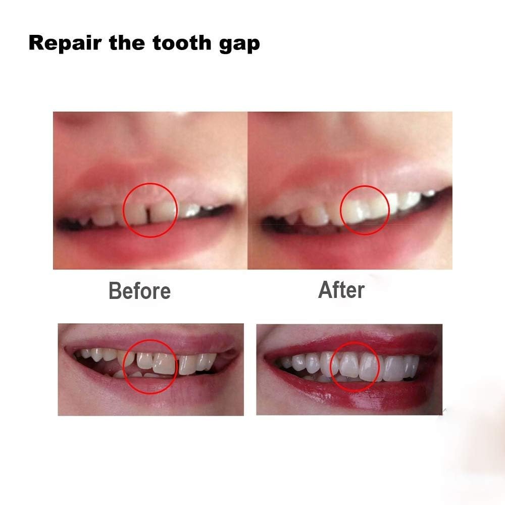 Tooth Filling Thermal Beads Do it Yourself Moldable False Teeth for Temporary...
