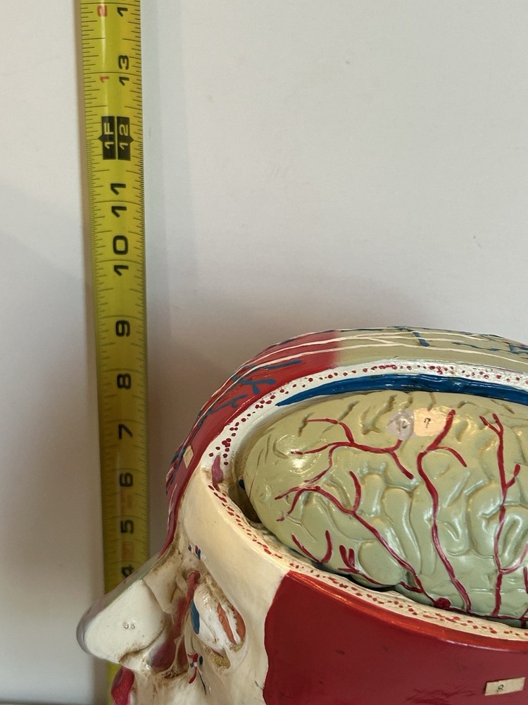Bobbitt Laboratories Anatomical Half Head Model Removable Brain Vintage