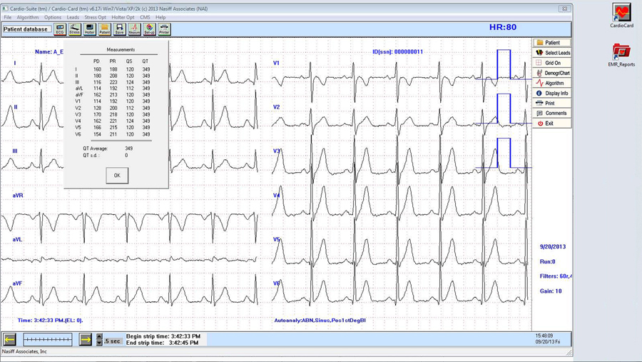 Nasiff Associates Cardiocard PC Based EKG with Software