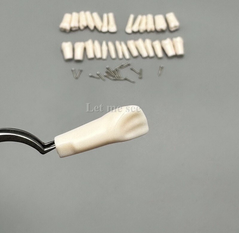 Dental Replacement Screw-in Teeth Typodont Models Study Practice Tooth Model