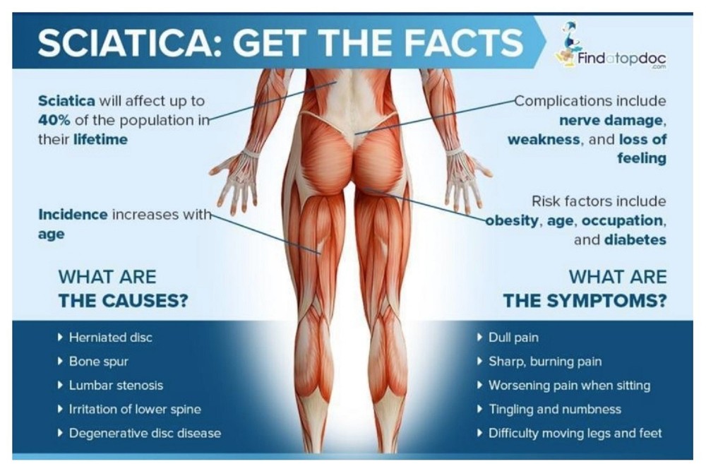 STOP SCIATICA NERVE PAIN - MADE IN USA - 240 CAPS