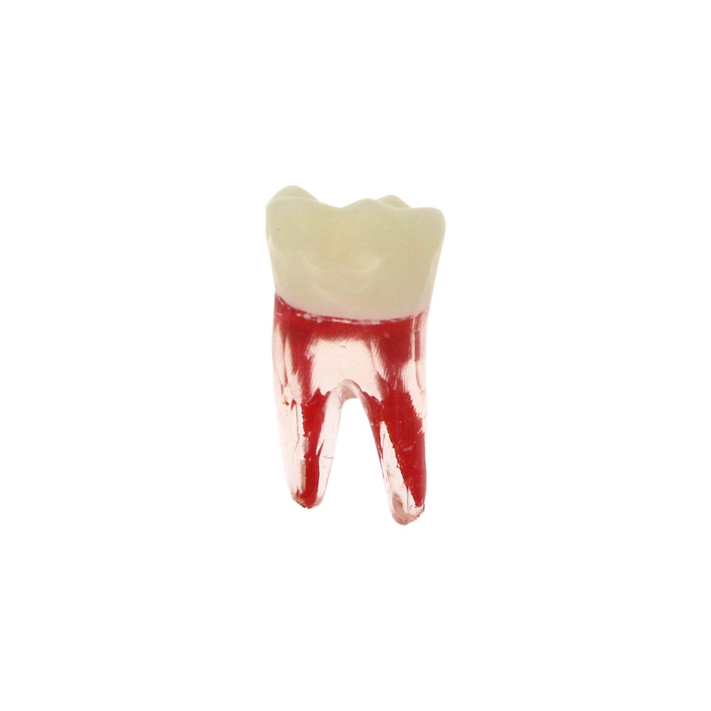 10Pcs Dental Root Canal Practice Model RCT Practice Endo Teeth Model Pulp Study
