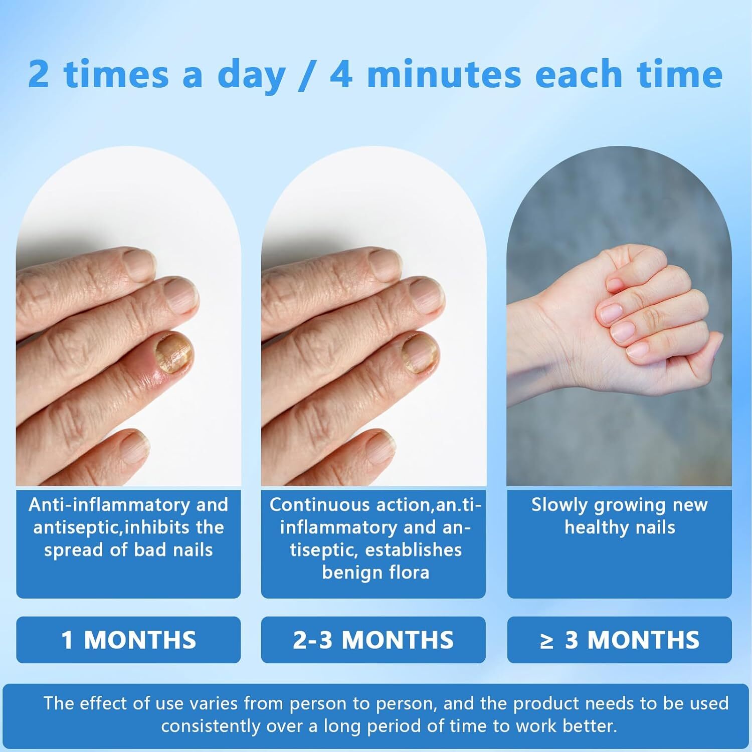 Advanced Nail Fungus Laser Removal Device For Toe And Finger Fungal Infection