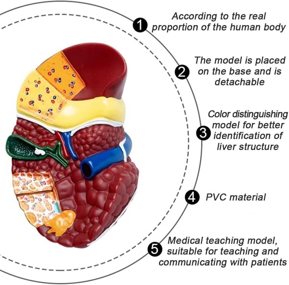 Pathological Liver Anatomical Model 1:1 Human Liver Model Anatomy Display Study