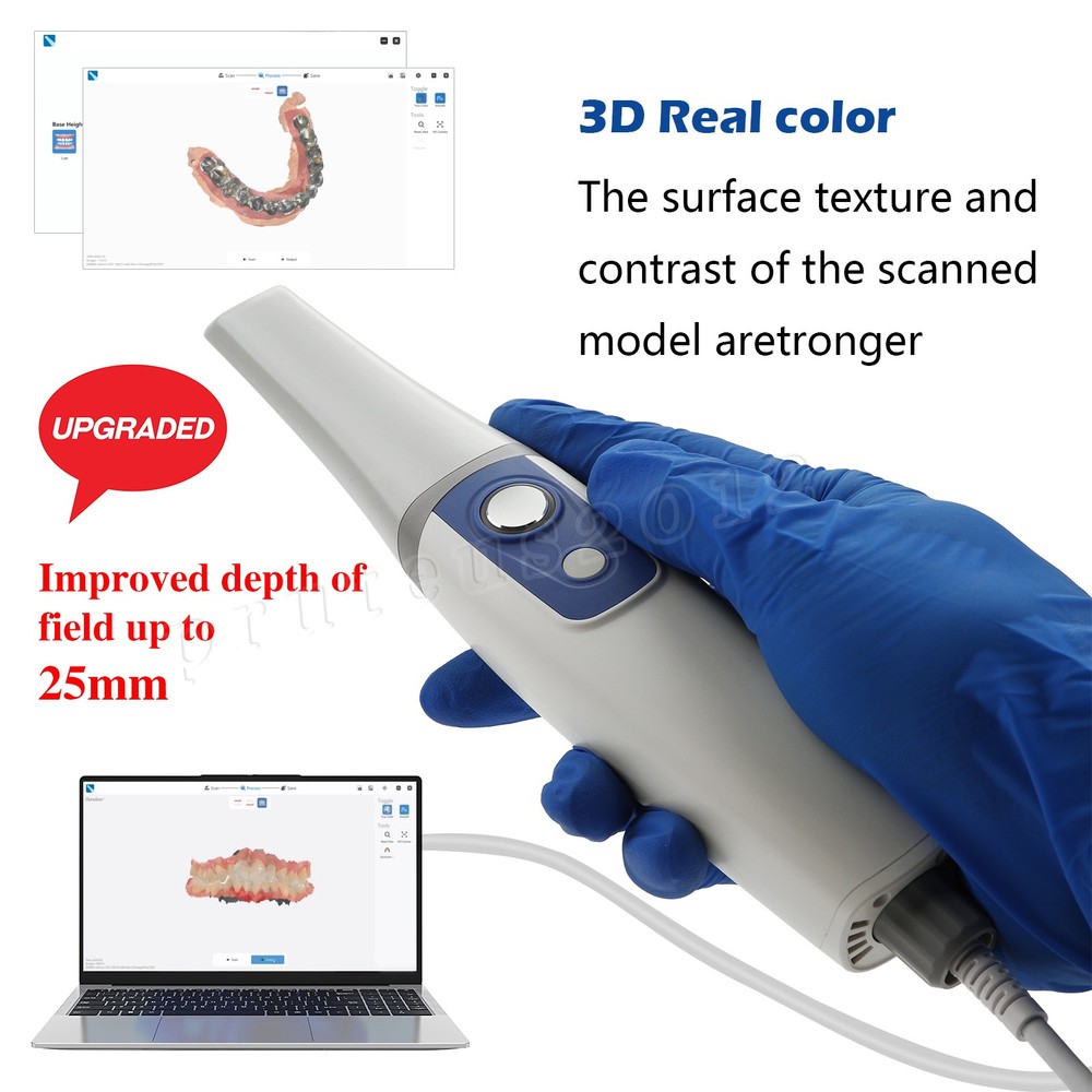 Digital Dentistry Intraoral Dental Scanner w/ Tips Software