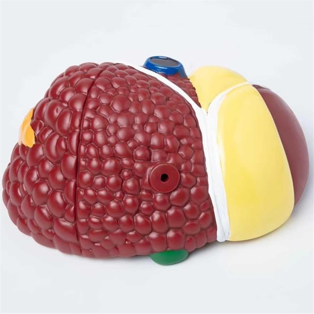 Pathological Liver Anatomical Model 1:1 Human Liver Model Anatomy Display Study