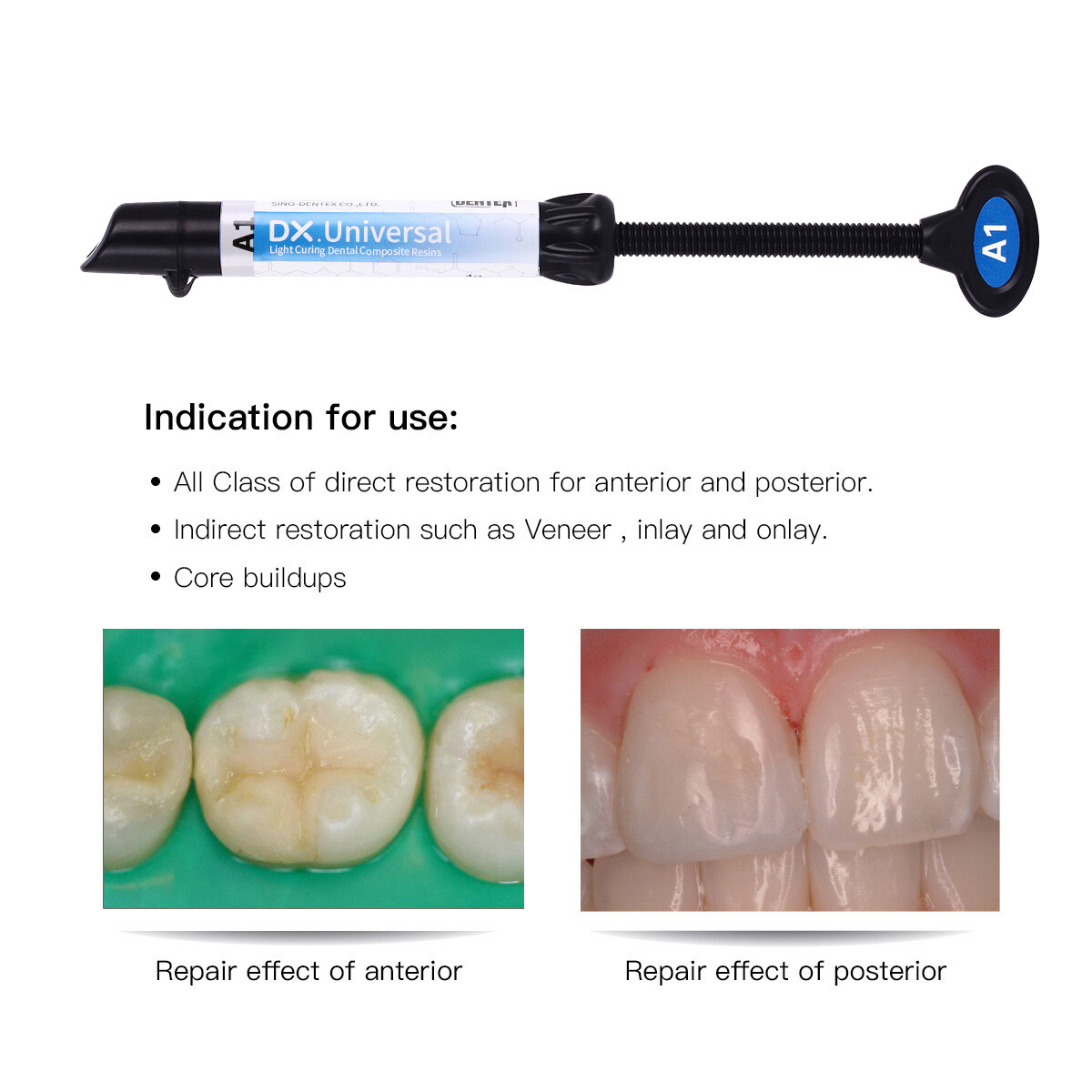 DENTEX Universal Dental Light Cure Hybrid Composite Resin A1/A2/A3/A3.5/B1/B2