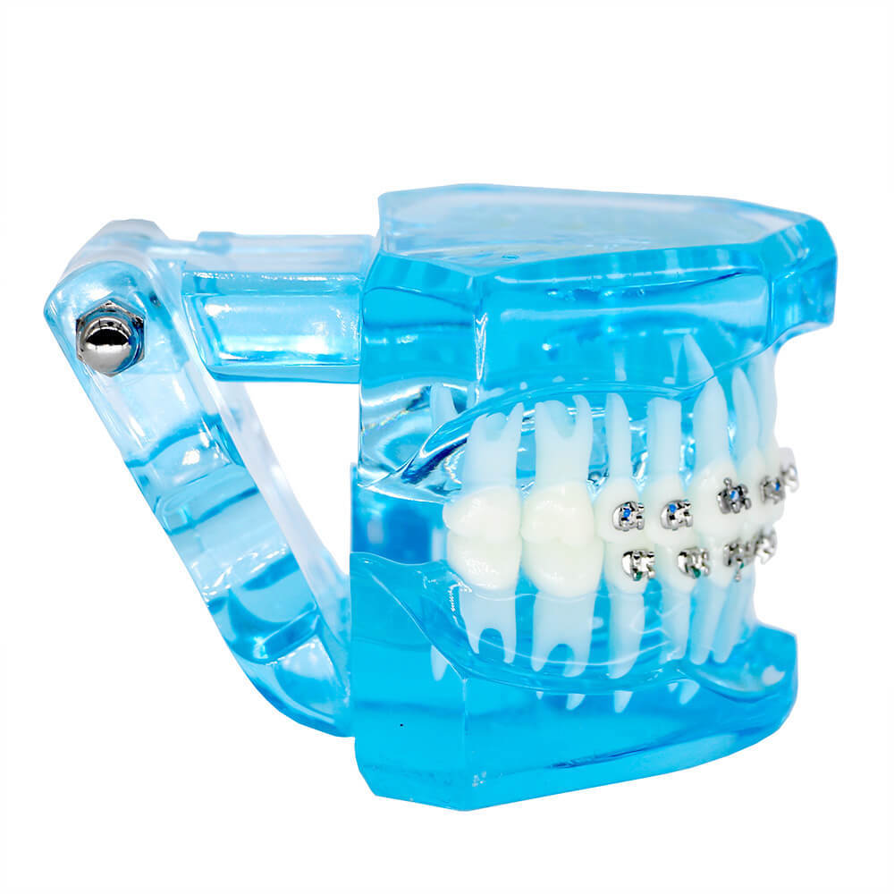 Dental orthodontic contrust teach study teeth model mental and ceramic bracket