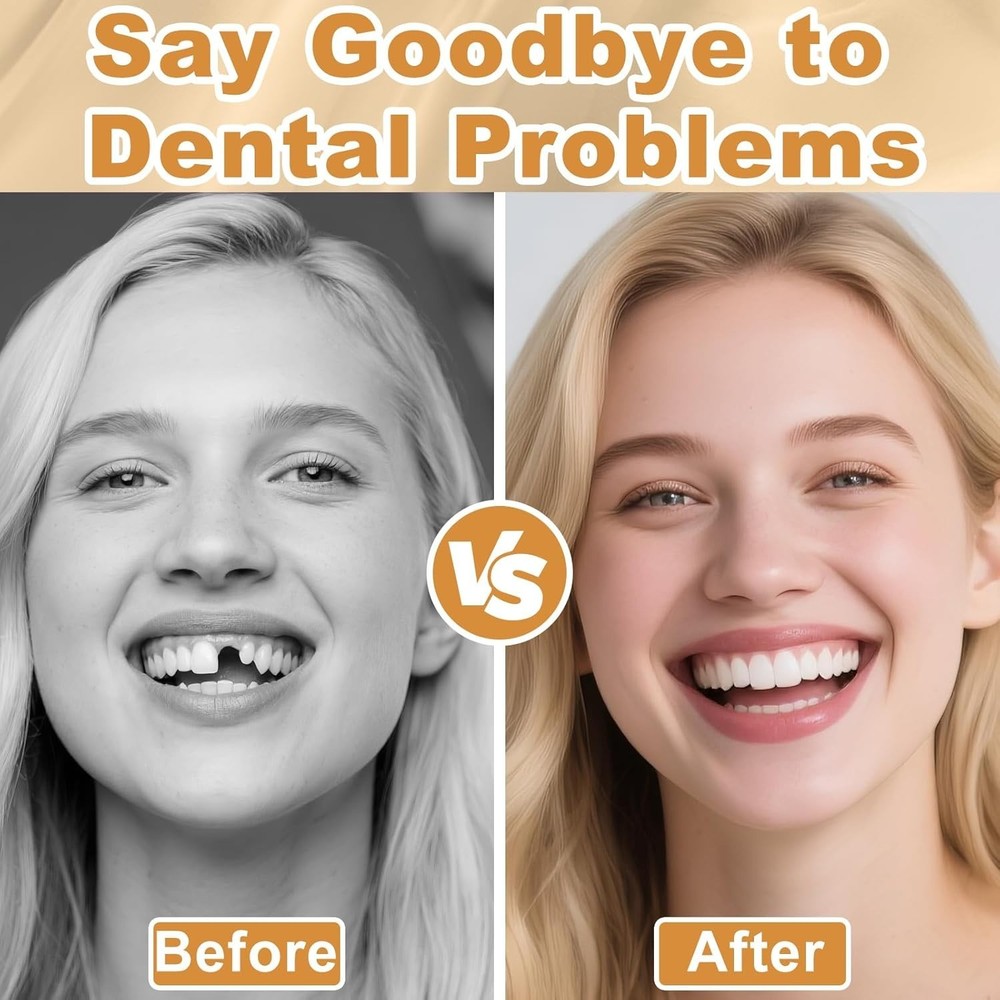 Moldable False Teeth Dentures Set Upper Lower Silicone Instant Smile Fix-M