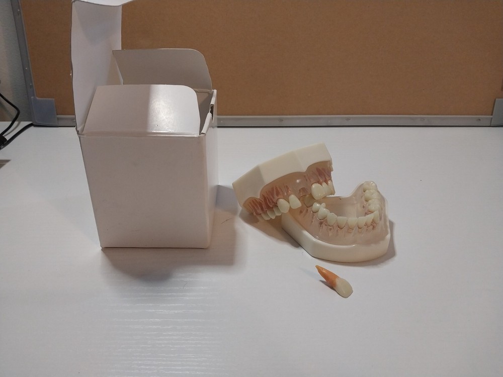 Dental Study Model Acadental