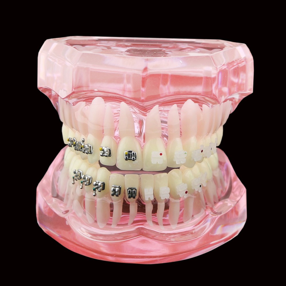 Dental Orthodontic Teeth Model Metal and Ceramic Bracket Study Teach Model 3003