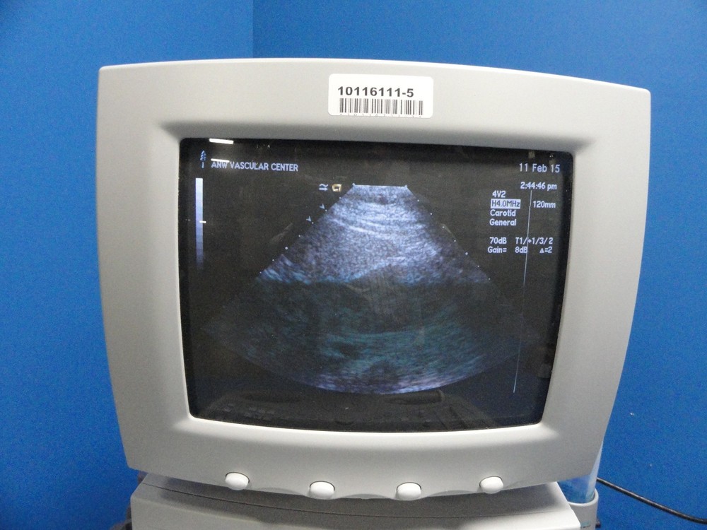 Siemens Acuson 4V2 Vector Array Ultrasound Probe – For Sequoia Series ~ 8588