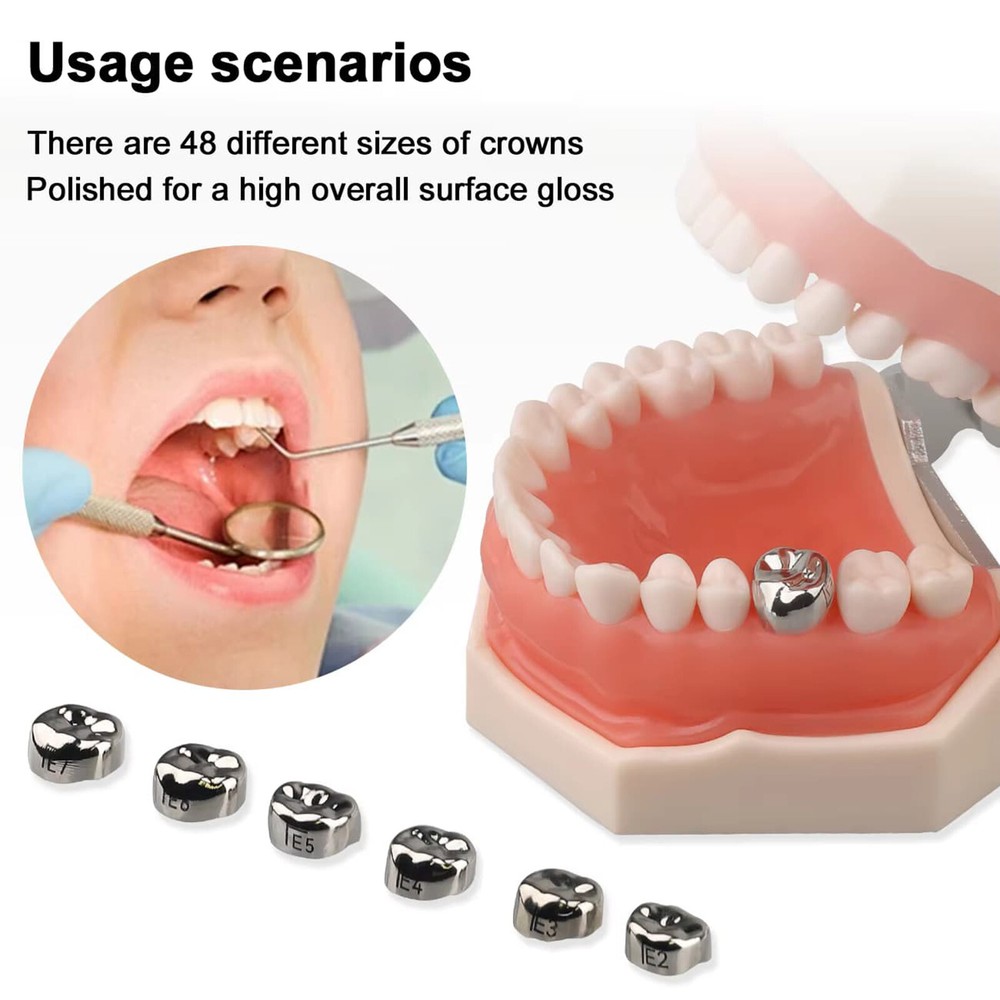 48 ASSORTED PRIMARY MOLAR STAINLESS STEEL CROWNS - COMPLETE KIT