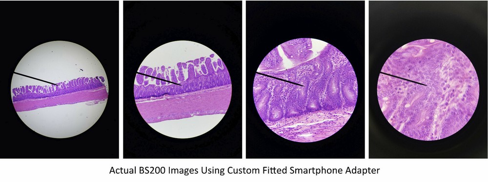 Sturdy Microscope Eyepiece Camera Adapter for Smartphone & iPhone