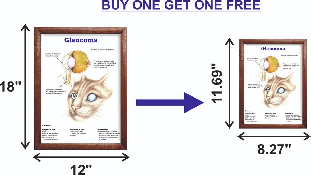 Glaucoma Chart 12x18 inches