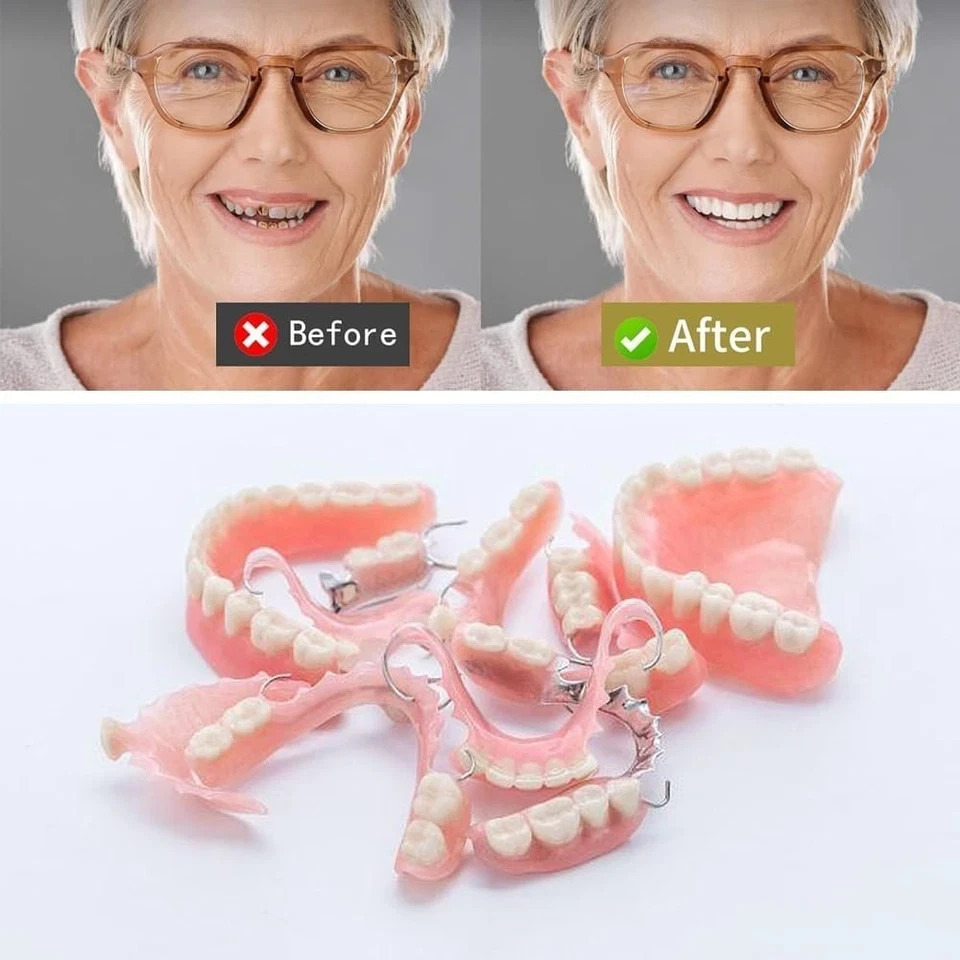 Gum Material Repair Strip for Missing Teeth Partial Full Dentures Quick Fix