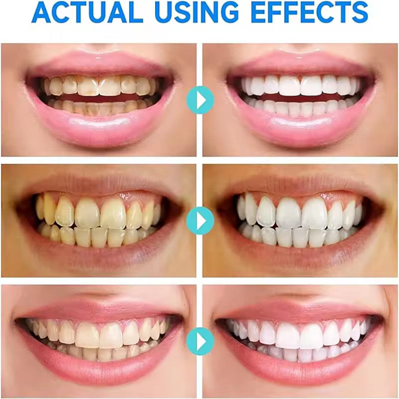 SP-6 Probiotic Whitening Toothpaste Refresh Mouth Brighten Remove Yellow Tooth