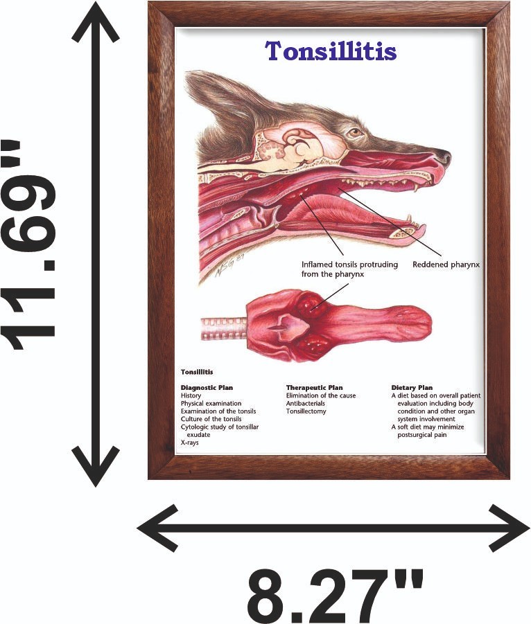 Tonsillitis Chart 12x18 inches