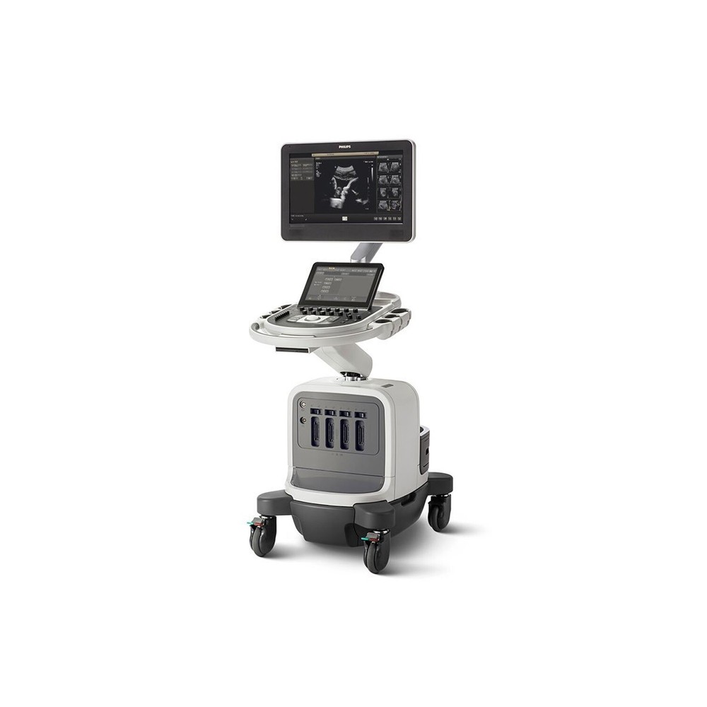 Philips Ultrasound Software