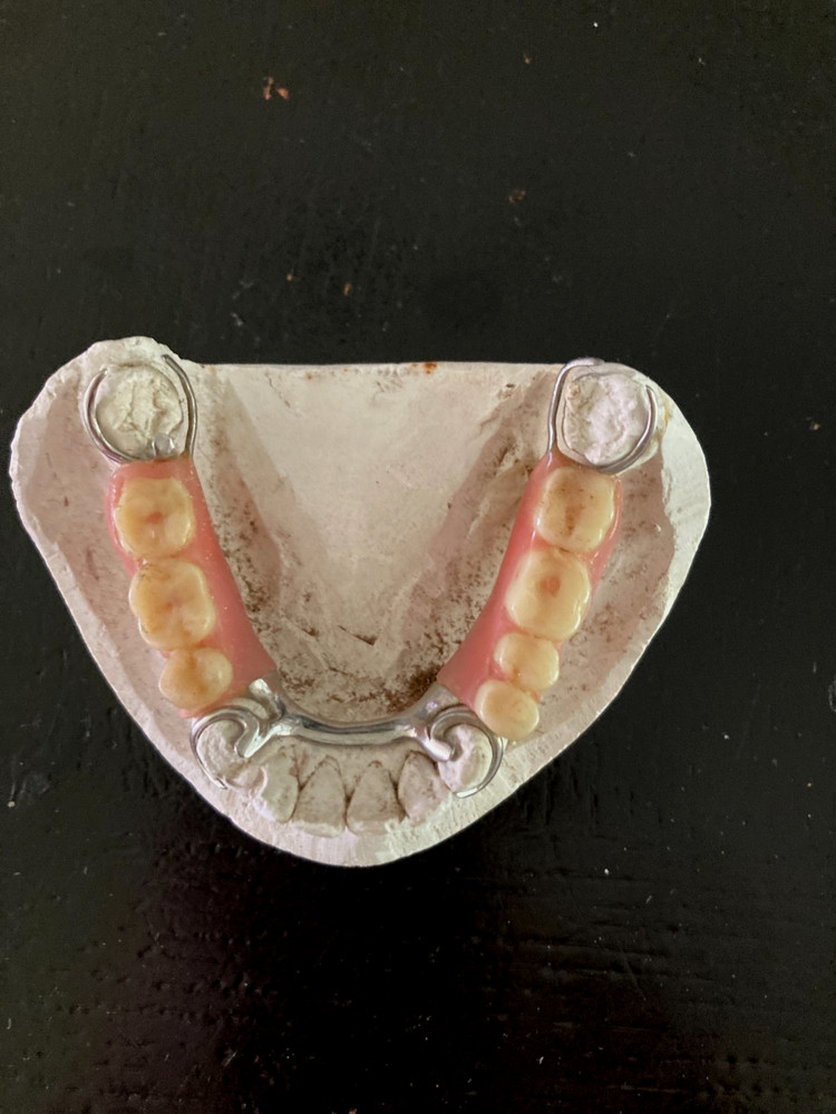 Dental Bridge Plate Training Aid