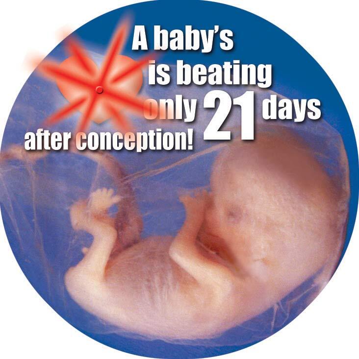Beating Heart Blinking Pro-Life Button (Pack of 25)