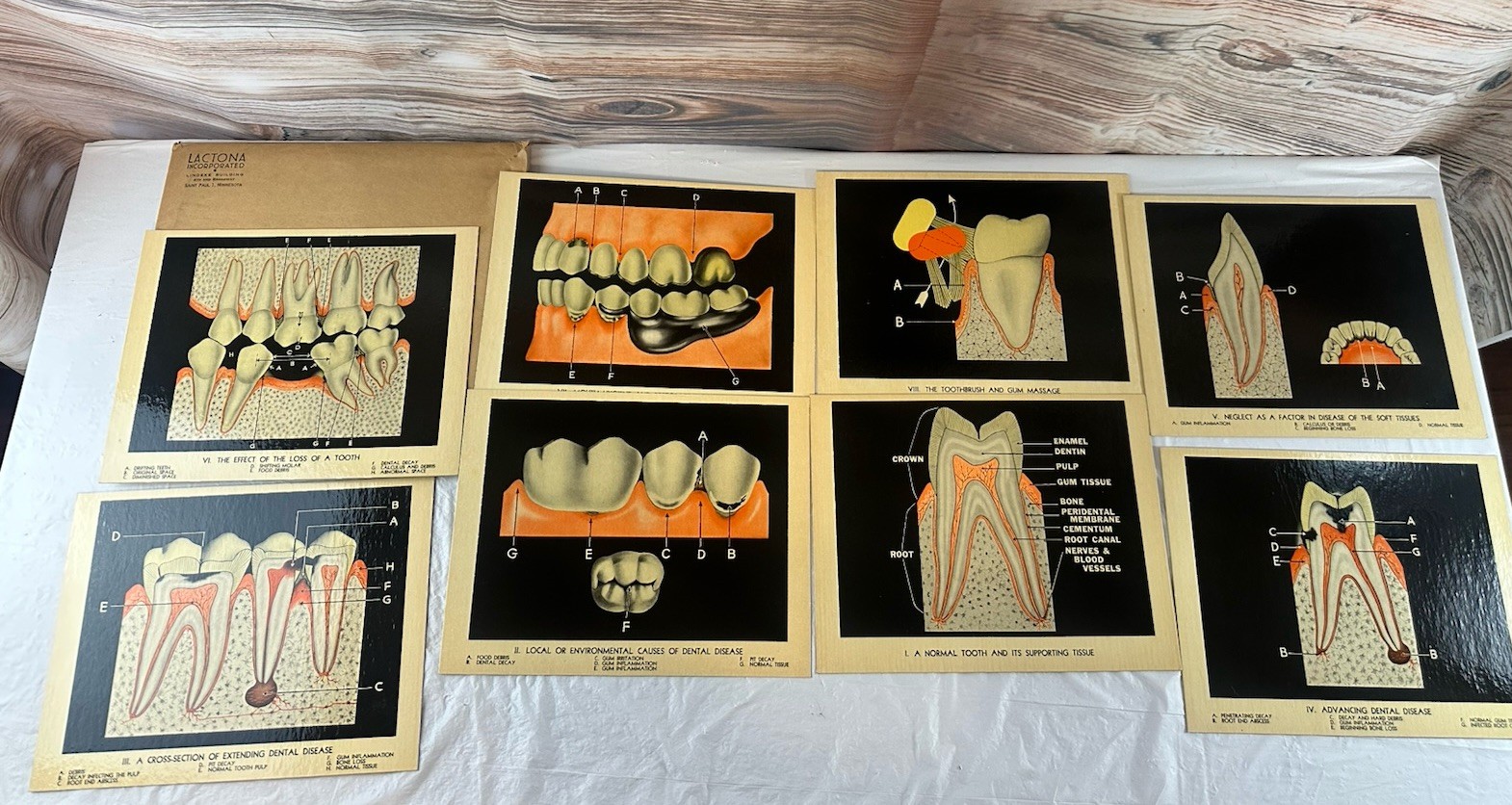 Vintage Lactona Inc Dental Anatomy Diagram Prints 11X8.5 Inches Dentistry