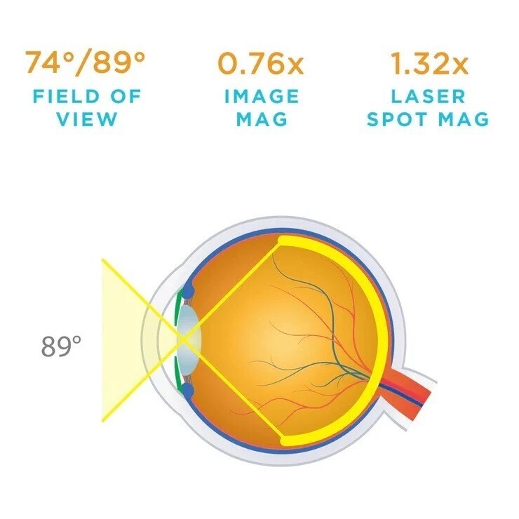 Volk 90D Double Aspheric Lens