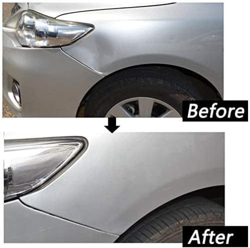 Paintless Dent Repair Kit with Bridge Puller - Effortless Dent Removal