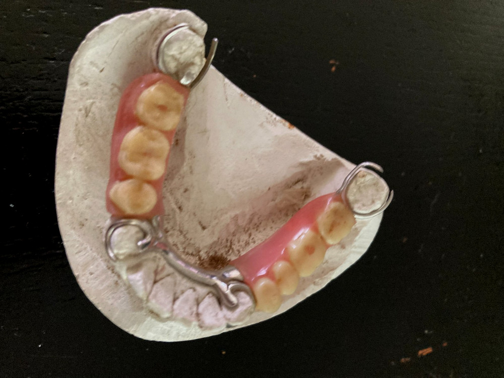 Dental Bridge Plate Training Aid