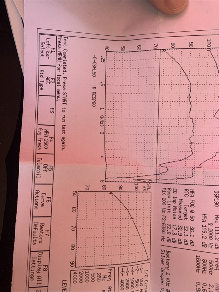 MIRASING OTC HEARING AIDS Rechargeable, Model R20D1