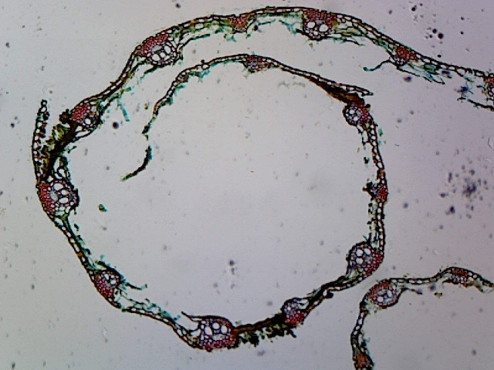 Puccinia Graminis Uredinia (Basidiomycetes); Section