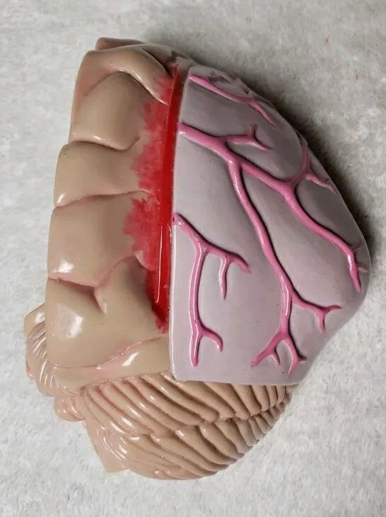 GPI Brain/ Partial Skull Model