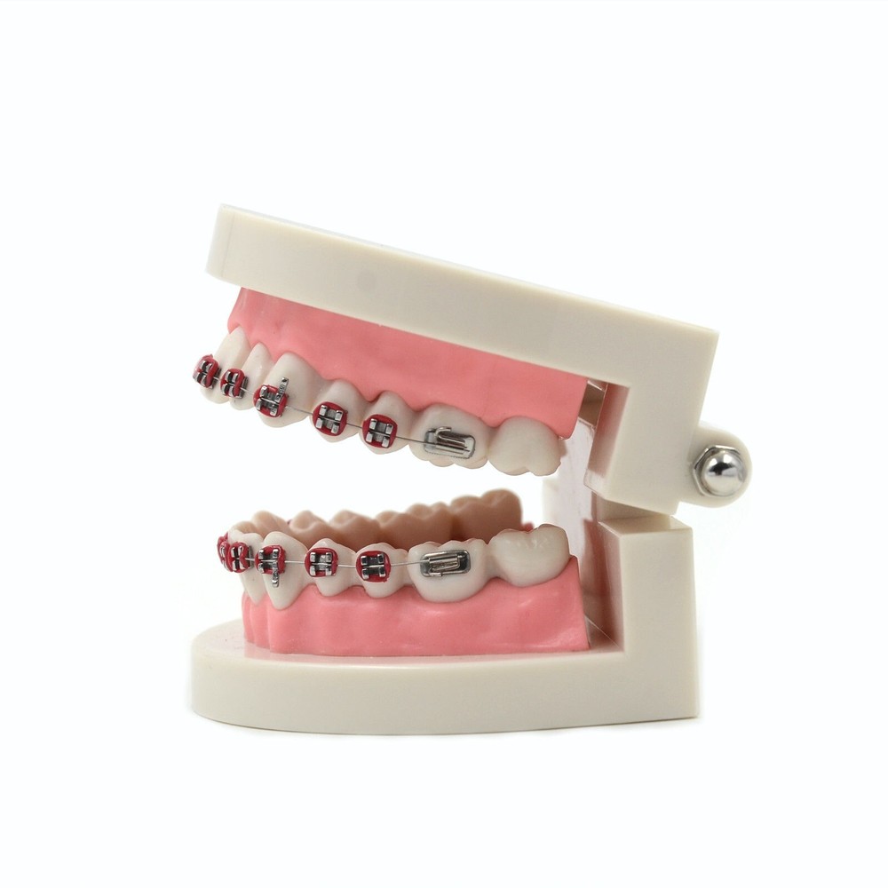 Dental Teach Typodont Demonstration Teeth Model with Braces For Patient Study